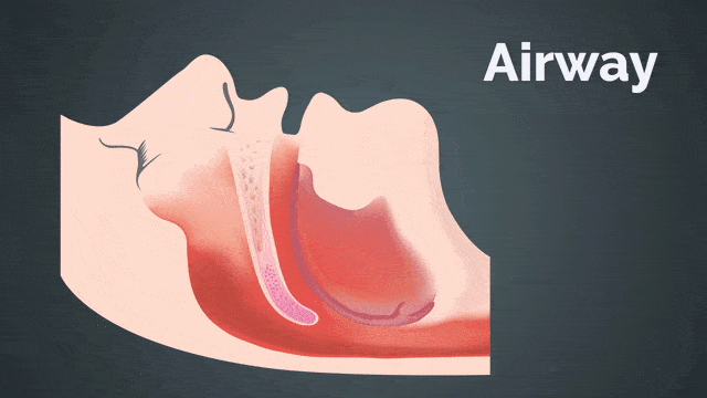airway graphic
